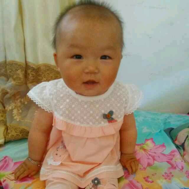 八个月女宝宝,头发特别少,怎么回事啊?