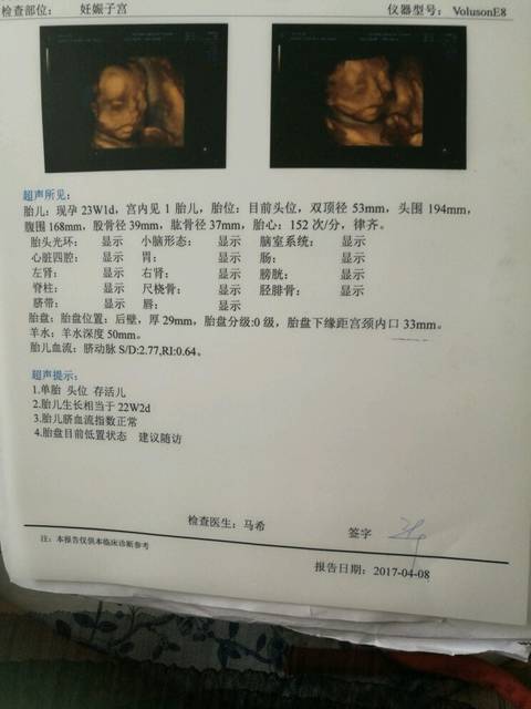 预约四维彩超怎么预约_昆山友谊医院有四维彩