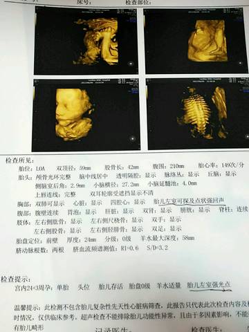 25周四维通过!男宝,附症状