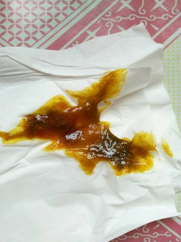 有知道的宝妈看一下两个多月的宝宝大便有血