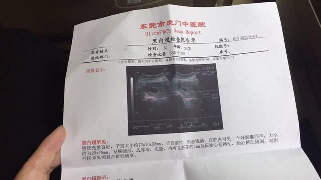 接健康胎心,胎芽的来_B超单显示有胎心胎芽,终