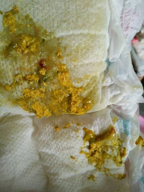 月子里宝宝拉肚子怎么办