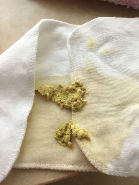 关于胎便颜色?有懂得宝妈吗?_剖腹产健康男宝