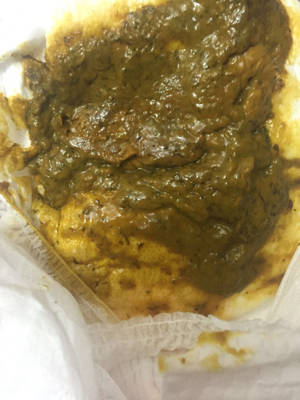 宝宝五个月了,今天第五天没拉便便了,今天就给他用了开塞露,拉出来的