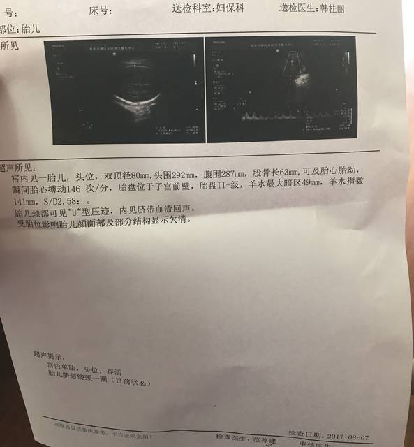 34+2 B超单 双顶径偏小 有没有影响