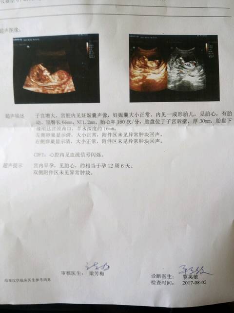 12周的 nt单子甩过来,帮你们看男女