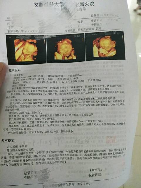 四维做过了，有点肾窦分离是怎么回事