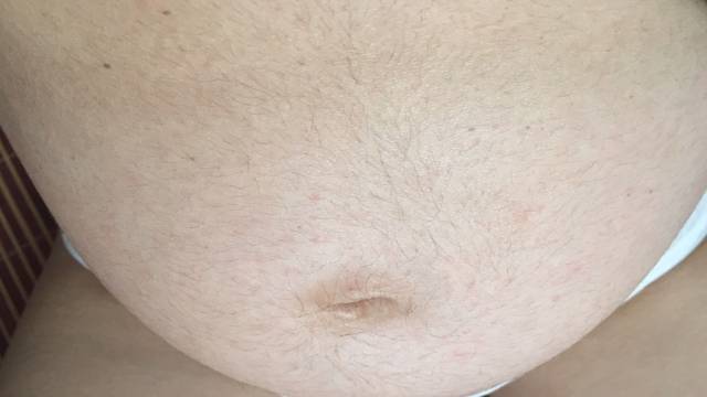 七个月肚子上有小红点 不痛不痒么 是不是过敏