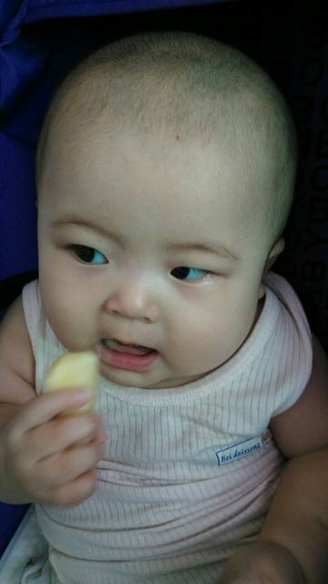 宝宝眼睛白眼球发蓝是怎么回事?