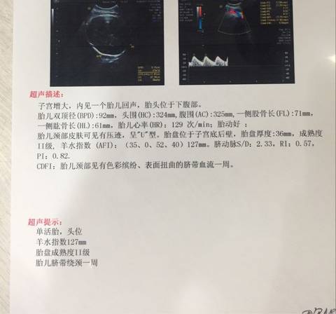 b超单看男女 孕妈早知道