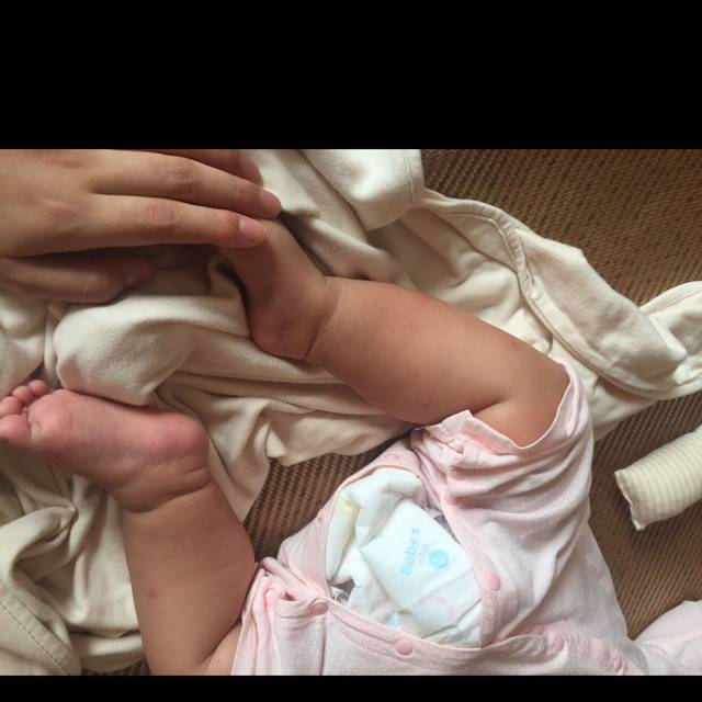 求助贴 请问是蚊子咬的还是皮肤病?_腿上多处