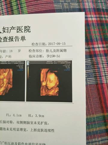 40天左右的孕囊图,或者四维图看男女