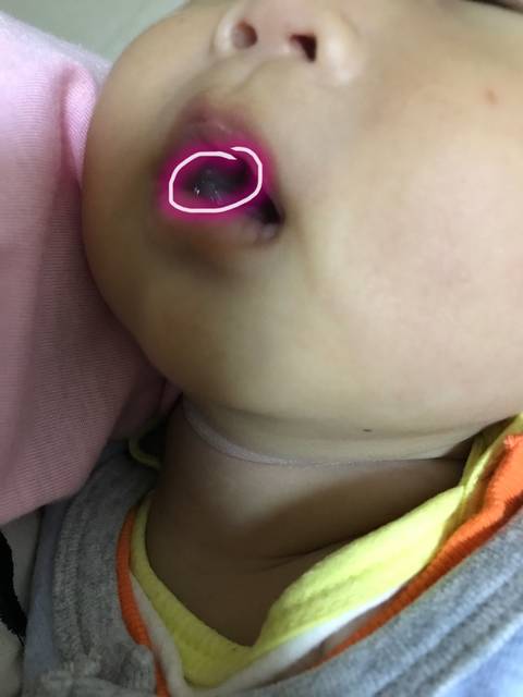 宝妈们请帮我看看_宝宝嘴里有个小白点,不知道