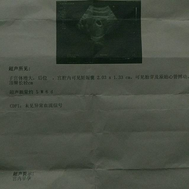 怀孕胚囊怎么分辨男女宝宝