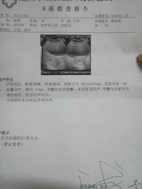 怀孕5周出现褐色血_怀孕5周出现褐色血,今天去