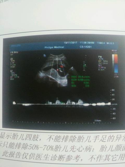 怀孕16周,昨天去坐产检,B超单子可以看出性别