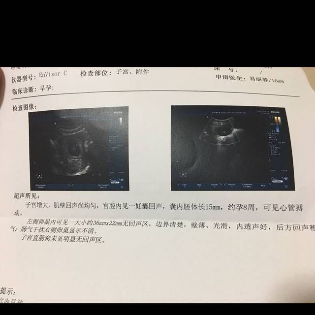 孕8周整，b超有胎心了_孕4周多开始有褐色分必物，五周多突然_宝宝树