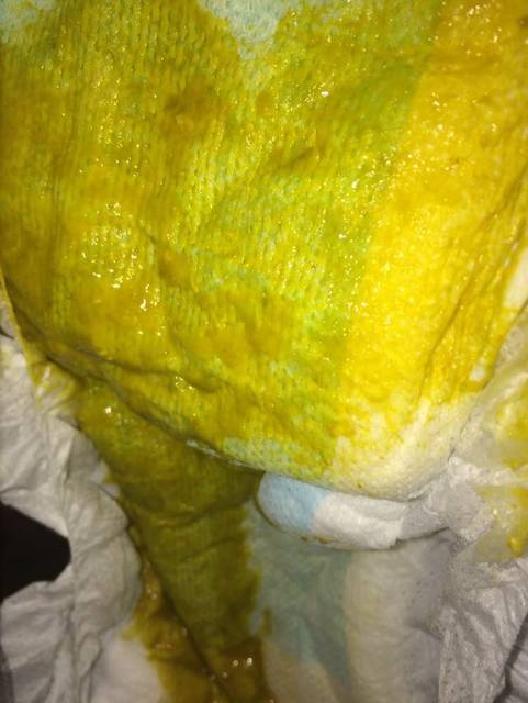 宝宝月子里大便很浓,最近一个月很稀_宝宝月子