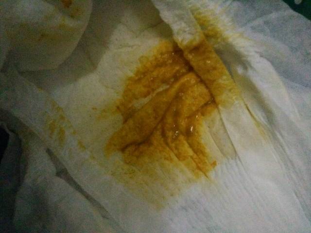 14天宝宝大便变成土黄色?_宝宝14了大便从金