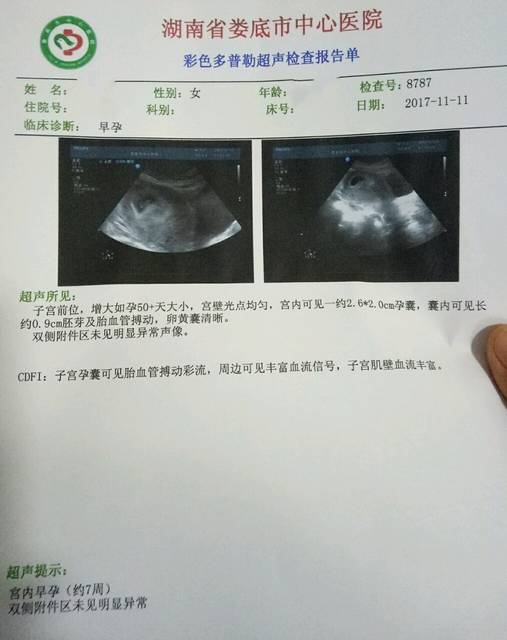 孕七周,一切正常,期待小家伙的到来