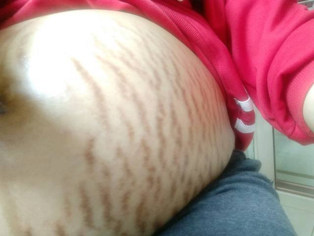 猜男女…一个星期揭晓…孕晚期妊娠纹疯长…_