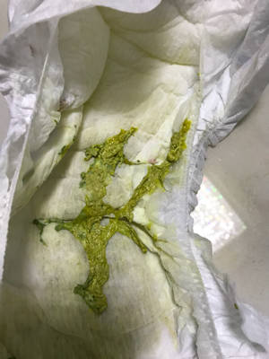 六个月的宝宝 添加辅食了 怎么会有这种便便