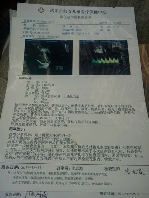胎儿肠管扩张。求解答今天胎儿34周。羊水偏