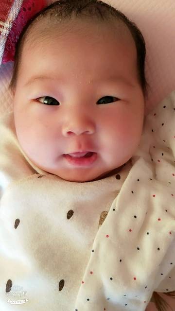 【新手报到】麻烦宝妈们看下宝宝上眼皮肿是不