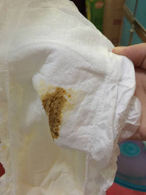 宝宝大便少颜色如图屁还很臭是什么原因?吃奶