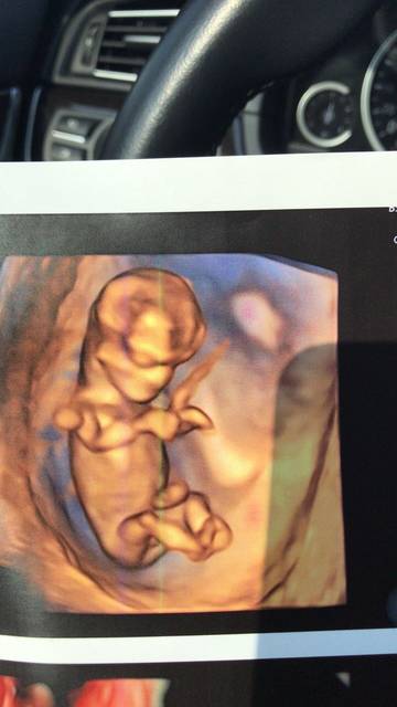 nt图这样是不是就是儿子了