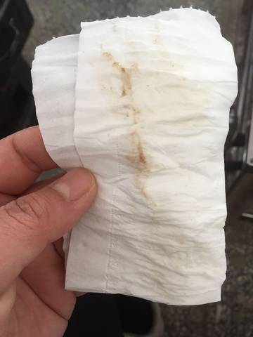 393上厕所鸡蛋清的东西,有一点点血丝呈褐色,肚子也疼了几天了,是见红