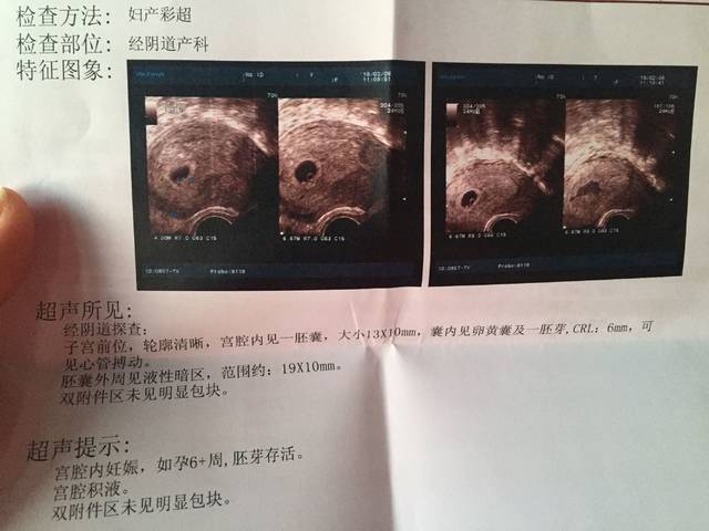 孕七周有宫腔积液怎么办