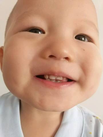 我家宝宝一岁五个月了,牙齿刚长出来是白色的
