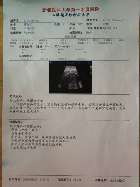 心脏b超有啥问题没?