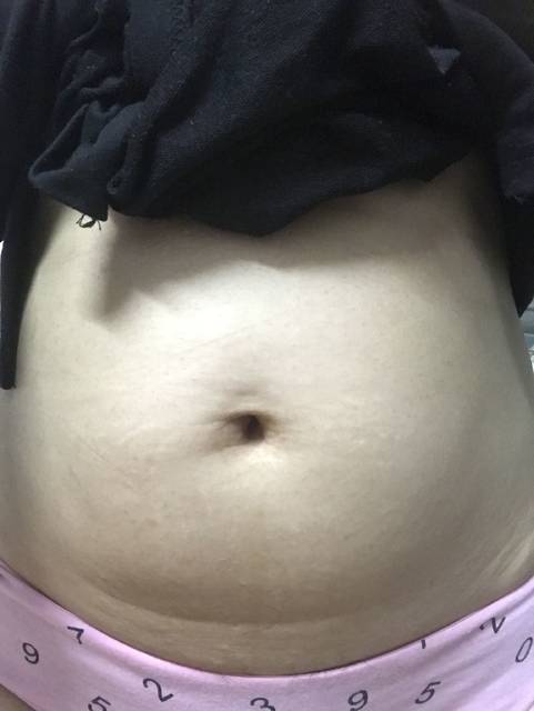 怀孕2月肚子就大正常吗