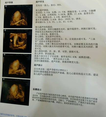 孕23周在杭州玛丽亚医院做的四维彩超,最大羊