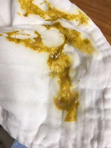 五个多月宝宝拉便便像鼻涕一样,平时便便很规