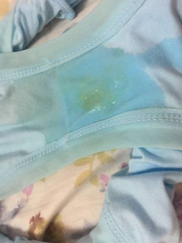 这是不是羊水破了的节奏,肚子每隔一段时间痛