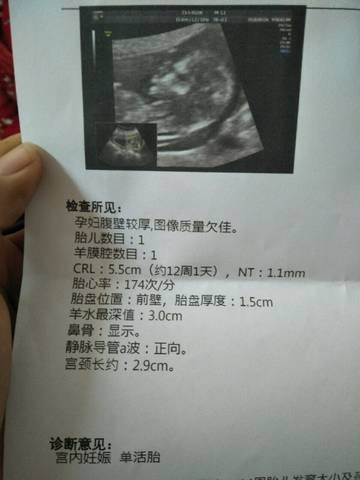 单子看男宝女宝