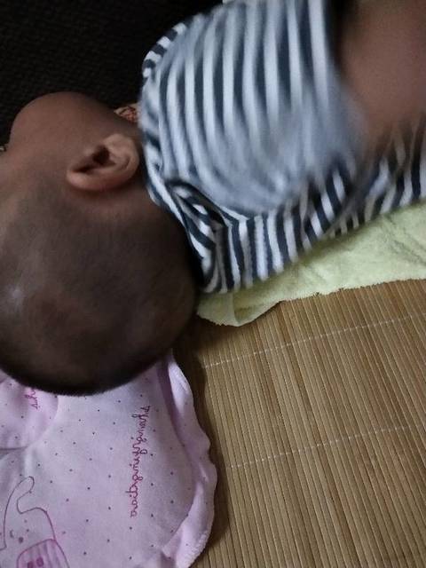 宝宝后脑勺长包