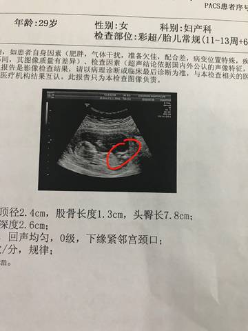 大家看我的13周的b超单子能看出男女么,画圈的地方是男的么?