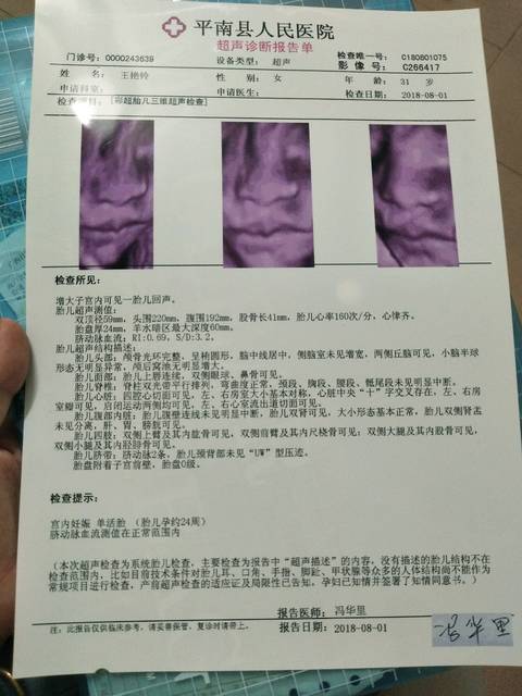 双肾孟未分离是女孩么,准么