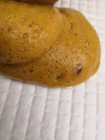 宝宝2个月24天,拉黄色泡沫便,持续2周了,医院化验大便