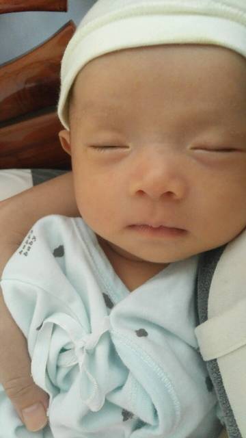 【新手报到】脂溢性湿疹 有图慎入!