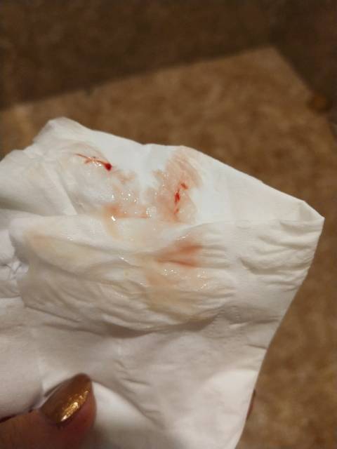 见红后多久会生