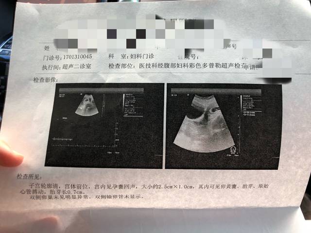 9.23末次,47天帮我看看b超是男宝女宝、