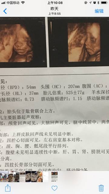 谭咏麟腹围肿胀粉丝忧心忽胖忽瘦曾四天瘦七公斤