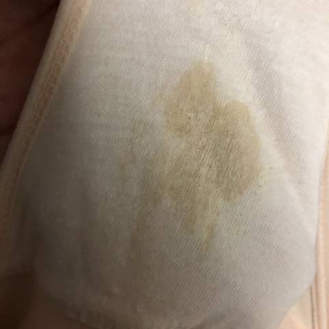 今晚内裤出现这种颜色的分泌物 请问是正常的吗?