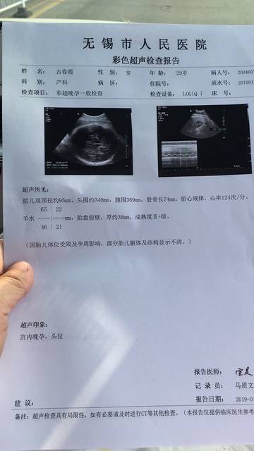 40周了,大家帮我看看这个b超数据,是顺还是剖