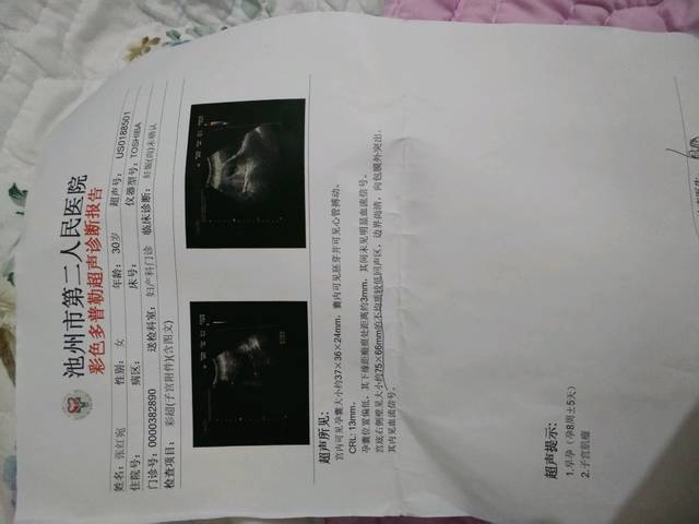 给经历过胎停且有子宫肌瘤的姐妹一些正能量